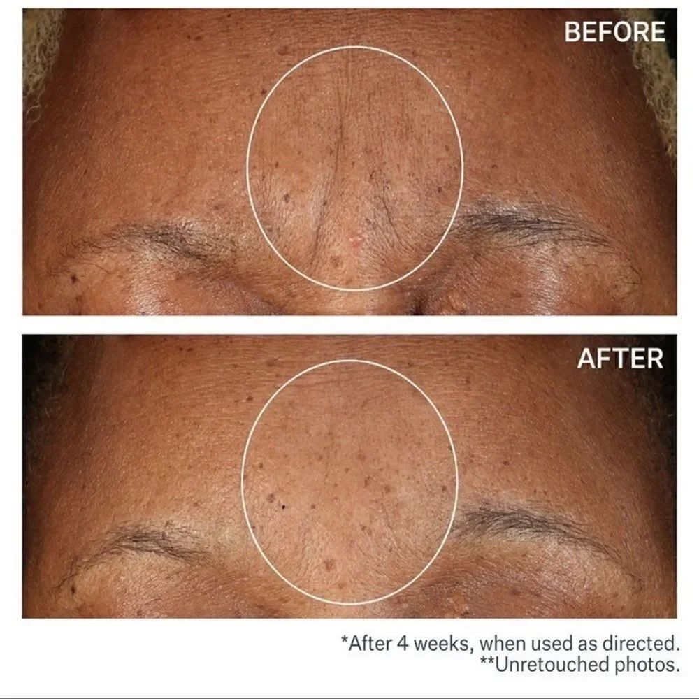 $15🌟 StriVectin Anti-Wrinkle SD Advanced Plus Intensive Moisturizing Cream - Picture 6 of 12